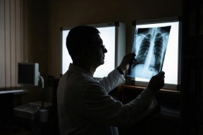 Заболеваемость туберкулезом в Томской области снизилась на 33%